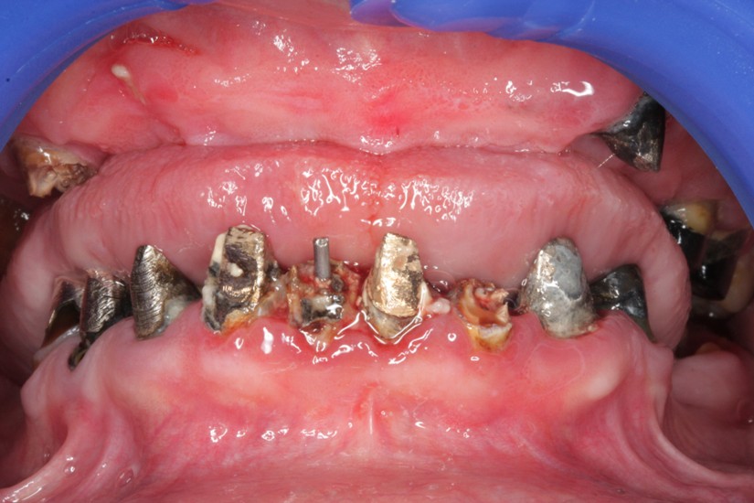 Photo 1.Initial clinical situation.