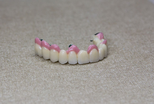 Photo 9.Ready cermet bridge of the maxilla